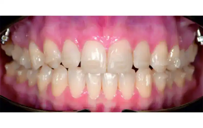 29-min-768x486.jpg