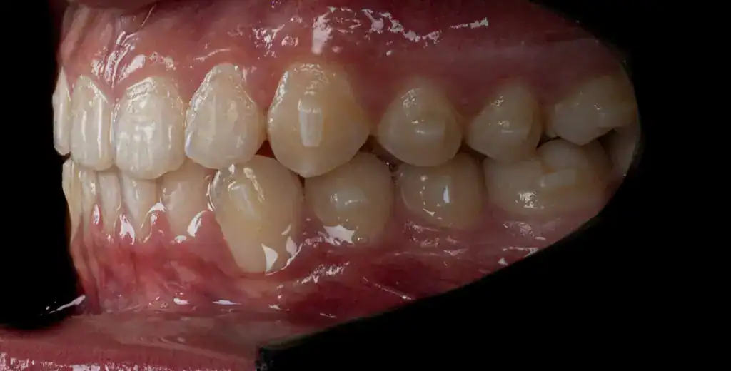 26-1024x520.jpg